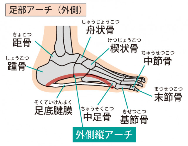 足のアーチが低下すると痛みが
